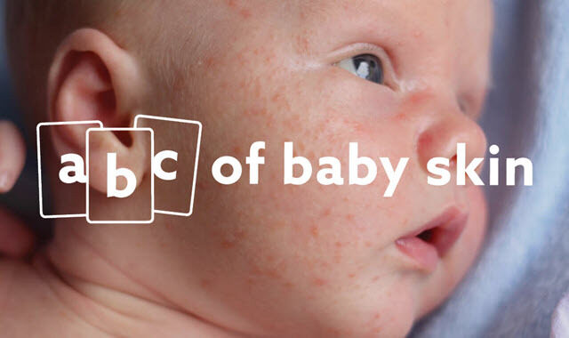 The ABC of Baby Skin: Caring for Every Little Bump and Patch
