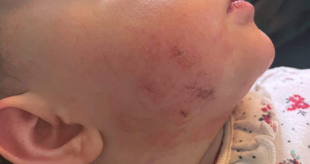 My Infant Is Scratching Their Face : What Should I Do?