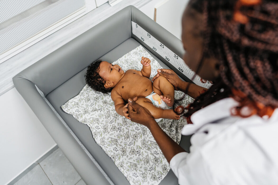 What To Do When Your Newborn Baby Has Jaundice